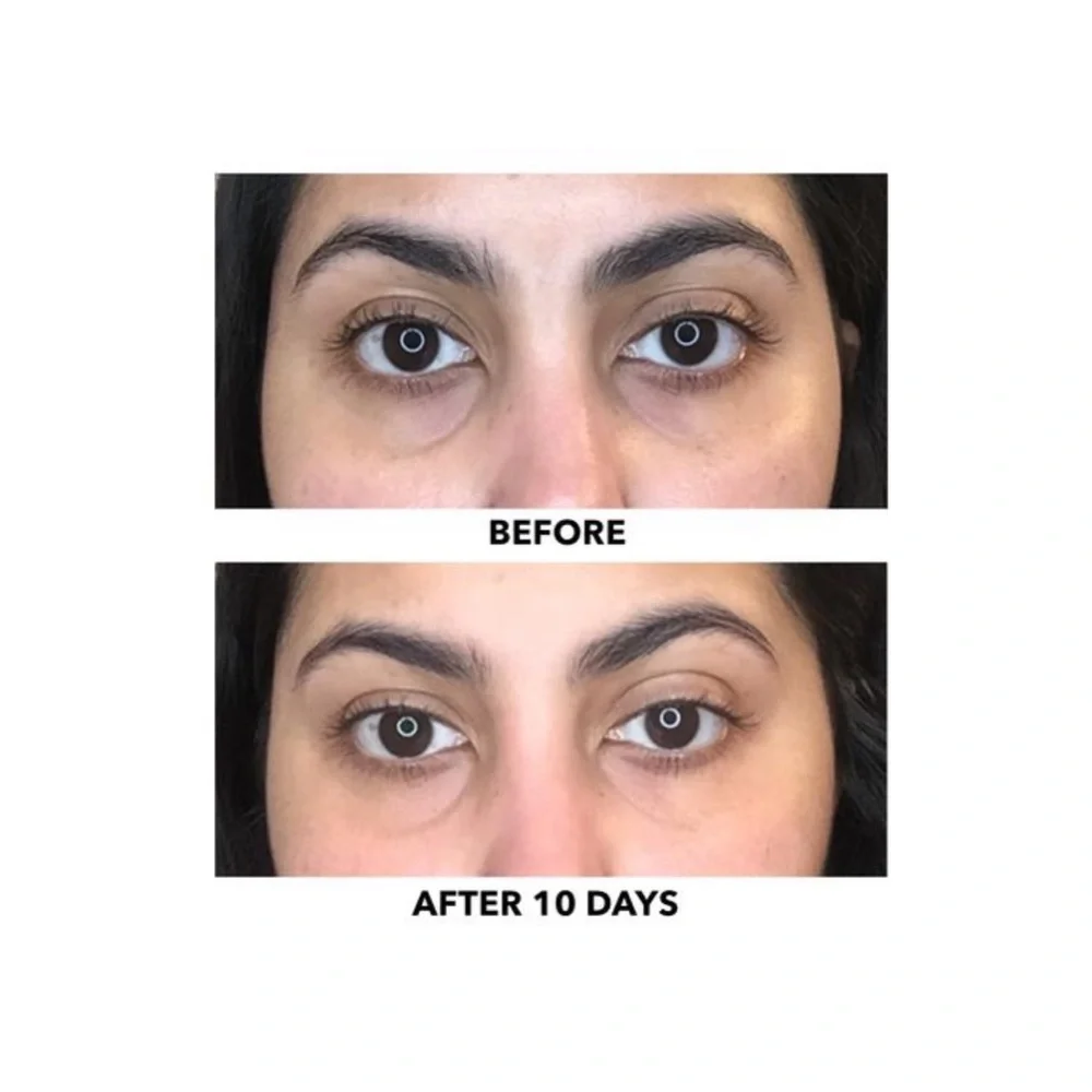 ALGENIST | Triple Algae Eye Renewal Balm
